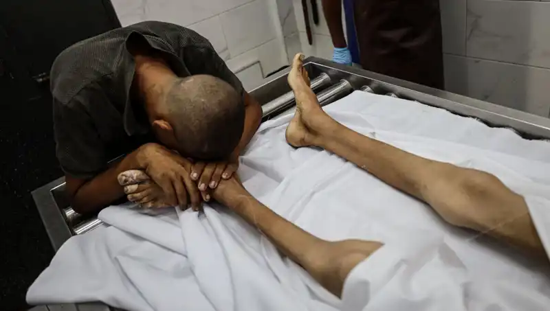 Gazze'de Açlıkla Savaş: Bir Çocuk Daha Hayatını Kaybetti