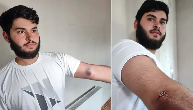 Mahallede Top Krizi: Conolar Kamyonetle Geldi, Herkes Şaşkına Döndü!